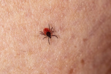 black legged tick on a person's skin